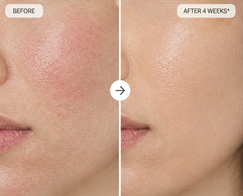 Before and After Results